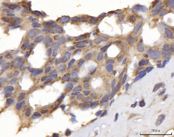 Anti-DLST Antibody