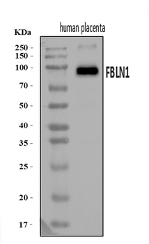 Fibulin 1/FBLN1 Antibody