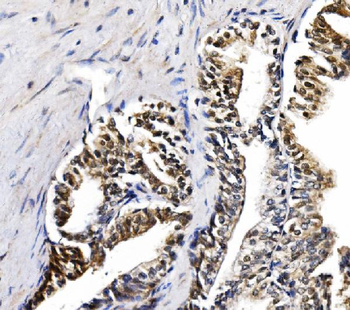 Anti-NOLA1/GAR1 Antibody
