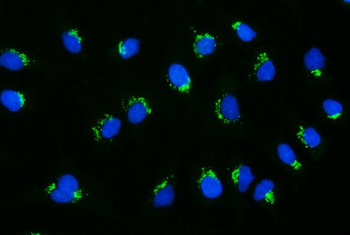 Anti-GCC1 Antibody