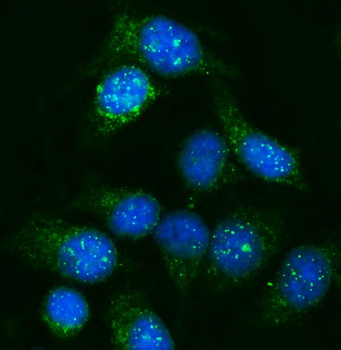 Anti-GNAL Antibody