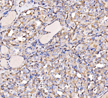Anti-HECTD1 Antibody