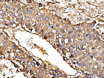 Anti-ORP150/HYOU1 Antibody