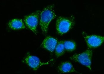 Anti-GPR54/KISS1R Antibody