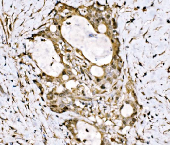 Anti-KLF15 Antibody