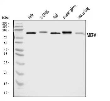 Pyrin/MEFV Antibody