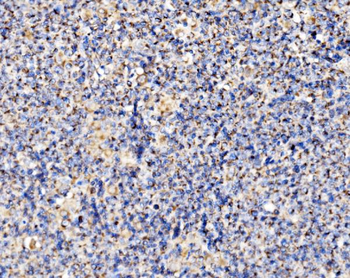 Anti-PMPCA/INPP5 Antibody