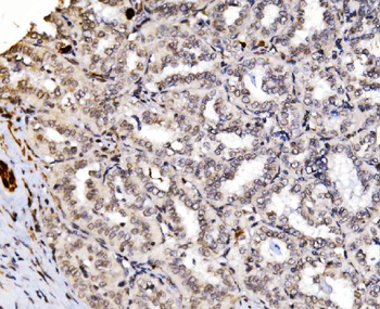 Anti-RAX2 Antibody