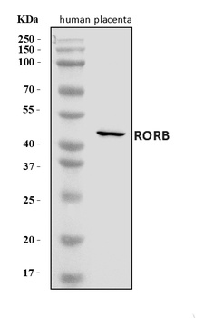 ROR beta/RORB Antibody