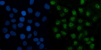 Anti-TMED5/p28 Antibody