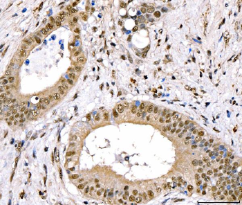 Anti-CRTC3 Antibody