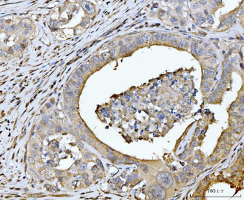 Anti-EDEM3 Antibody