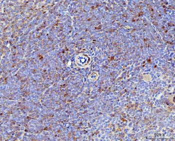 Anti-IL-17A/Il17a Antibody
