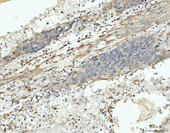 Anti-MT-ND5 Antibody