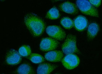 Anti-OS9 Antibody