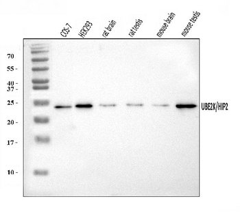 HIP2/LIG/UBE2K Antibody
