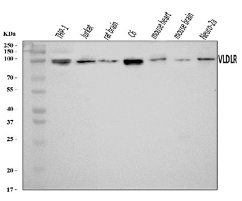 VLDL Receptor/VLDLR Antibody