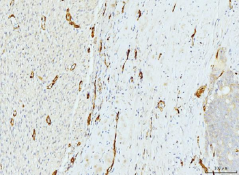 Anti-FABP4 Antibody (monoclonal, 10E12)