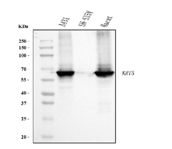 Cytokeratin 5 Antibody (monoclonal, 5D3F7)