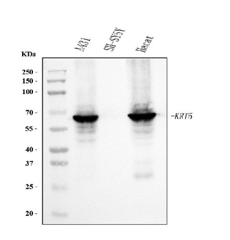 Cytokeratin 5 Antibody (monoclonal, 9H2F8)