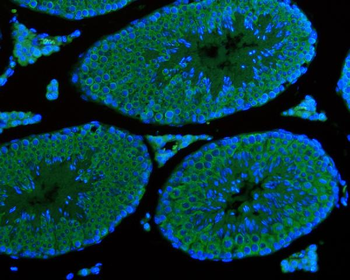 Anti-DDX4/MVH Antibody (monoclonal, 3C3)