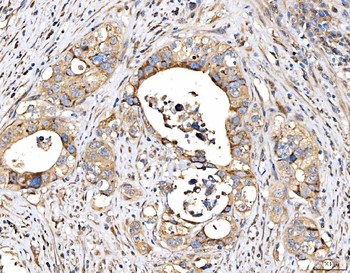 Anti-MRP3/ABCC3 Antibody