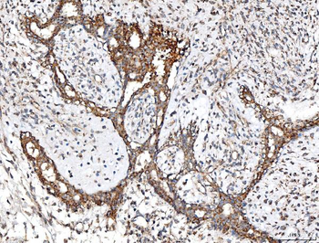 Anti-ACADM/MCAD Antibody