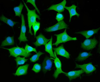 Anti-ALDH3A1 Antibody