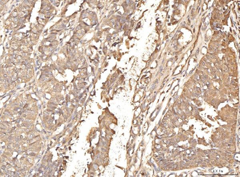 Anti-BHMT Antibody