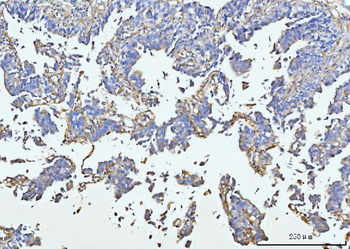 Anti-COL6A1 Antibody