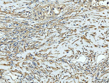 Anti-FHL2 Antibody