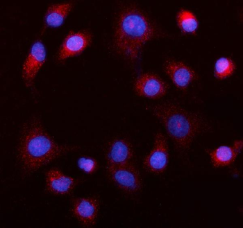 Anti-MEK5/MAP2K5 Antibody