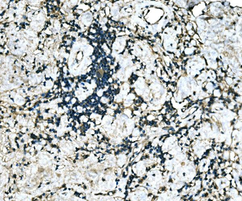 Anti-MEF2B Antibody