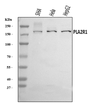 Anti-PLA2R/PLA2R1 Antibody