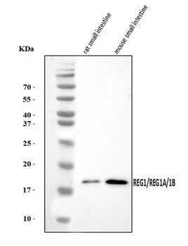 Anti-REG1A/1B Antibody