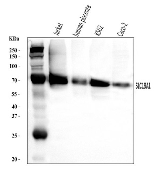 RFC/SLC19A1 Antibody