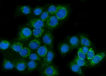 Anti-Glutaminase/GLS Antibody (monoclonal, 9G6)