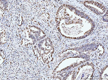 Anti-MCM6 Antibody (monoclonal, 3I4C8)