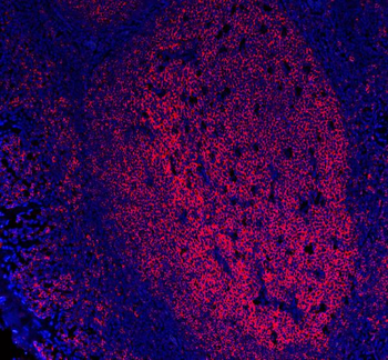 Anti-CD20/MS4A1 Antibody (monoclonal, 4I11)