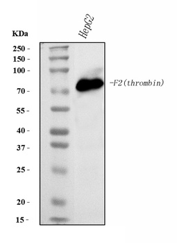 Prothrombin Antibody (monoclonal, 4G13G9)