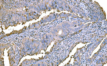 Anti-Prothrombin Antibody (monoclonal, 4G13G9)