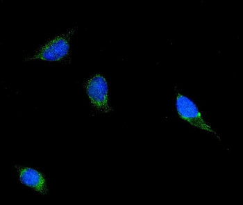 Anti-Filamin B/FLNB Antibody (monoclonal, 11E2D2)