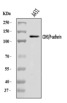 P cadherin/CDH3 Antibody