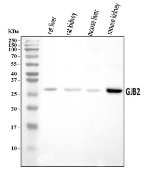 Anti-GJB2 Antibody