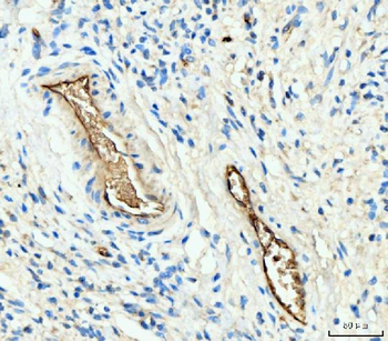 Anti-Hemoglobin/HBA1/HBA2 Antibody