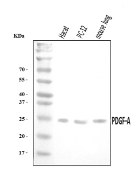 PDGF AA/PDGFA Antibody