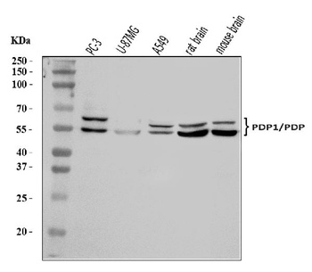 PDP1/PDP Antibody