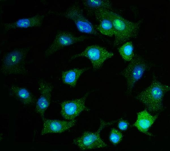 Anti-PSMD8 Antibody