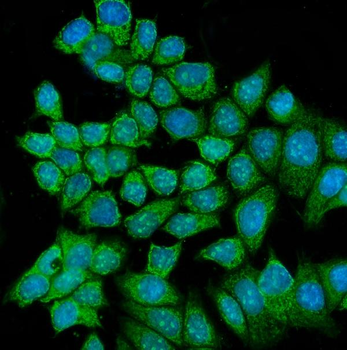 Anti-RCC2 Antibody