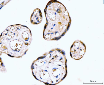 Anti-RYR2 Antibody